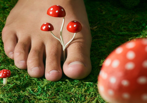 How do you disinfect shoes after toenail fungus?